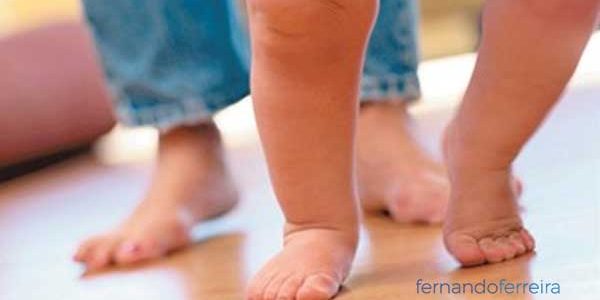 anteversión femoral