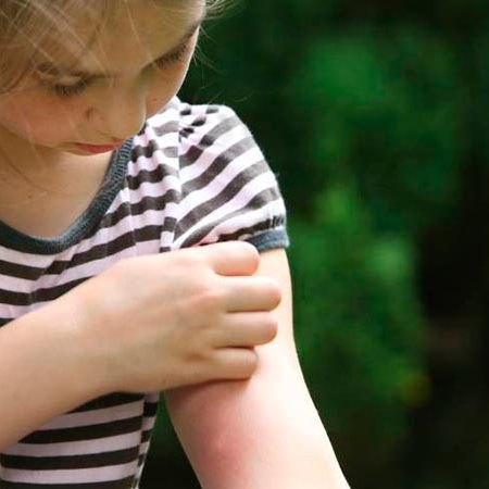 dermatologia-infantil-centro-pediatrico-sevilla