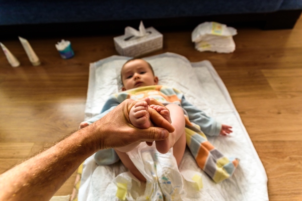 Cómo prevenir la dermatitis causada por el pañal